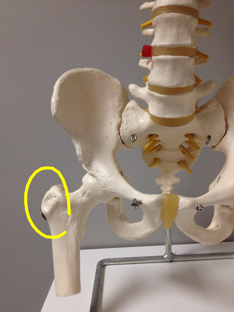 skeleton femur hip pain