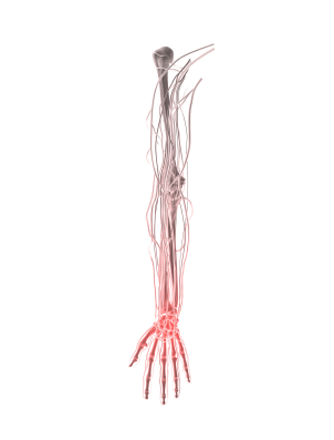 pinched nerve of arm