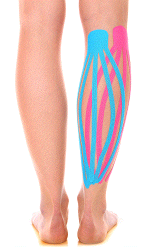 leg with kineiotape