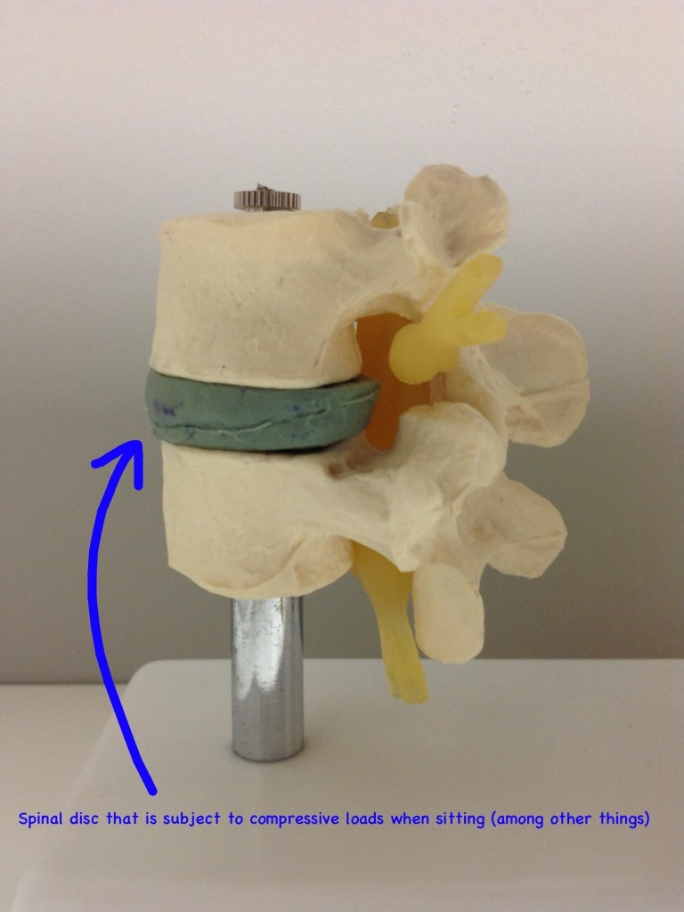 spinal disc model