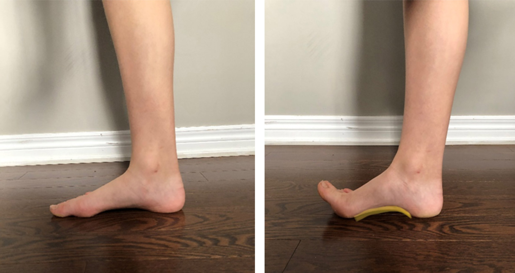 12 Best Flat Feet Exercises to Help Relieve Pain, Simply Feet