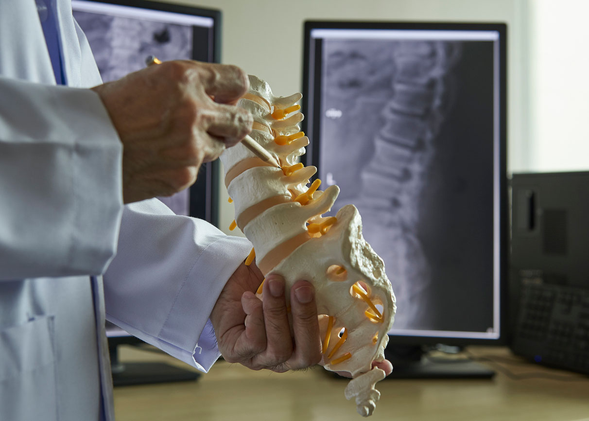 vertebra model with xray behind