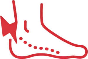 plantar fasciitis